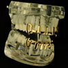 14K Gold Plated Vertical Bars Vampire Fangs Grillz Set