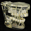 14K Gold Plated w/ Silver Diamond Cuts Top Teeth Grillz