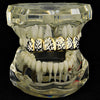 14K Gold Plated w/ Silver Diamond Cuts Top Teeth Grillz