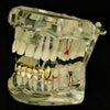 14K Gold Plated Wavy Iced Bottom Vampire Fangs Grillz