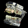 14K Rose Gold Plated 4 Open Top Vampire Teeth Fang Grillz