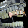 14K Rose Gold Plated 4 Open Top Vampire Teeth Fang Grillz