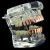 14K Rose Gold Plated 8 on 6 Teeth Grillz Set