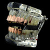 14K Rose Gold Plated 8 on 6 Teeth Grillz Set