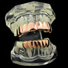 14K Rose Gold Plated 8 on 6 Teeth Grillz Set