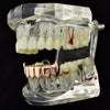 14K Rose Gold  Plated Bottom Vampire Fangs Teeth Grillz