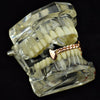 14K Rose Gold Plated Cuban Bottom Vampire Fangs Grillz