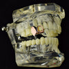 14K Rose Gold Plated Double Right Top Vampire Fang Teeth