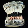 14K Rose Gold Plated Eight Tooth Bottom Vampire Fang Grillz