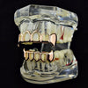 14K Rose Gold Plated Four Open Face Vampire Teeth Fangs Set