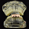 14K Rose Gold Plated Four Tooth Bottom Teeth Grillz
