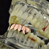 14K Rose Gold Plated Four Tooth Bottom Teeth Grillz