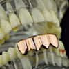 14K Rose Gold Plated Four Tooth Bottom Teeth Grillz