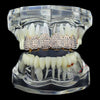 14K Rose Gold Plated Micro Pave Iced Top Teeth Grillz