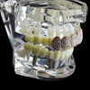 14K Rose Gold Plated Micro Pave Iced Top Teeth Grillz