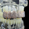 14K Rose Gold Plated Micro Pave Iced Top Teeth Grillz