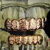 14k Rose Gold Plated Nugget Teeth Grillz Set