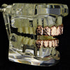 14k Rose Gold Plated Nugget Teeth Grillz Set