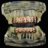 14k Rose Gold Plated Nugget Teeth Grillz Set