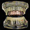 14K Rose Gold Plated Nugget Top Teeth Grillz