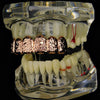 14K Rose Gold Plated Nugget Top Teeth Grillz