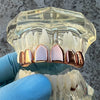 14K Rose Gold Plated Permanent Cut Perm Cuts Top Teeth Pre-Made Grillz
