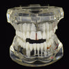 14K Rose Gold Plated Plain Gap Single Cap Tooth Grillz