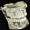 14K Rose Gold Plated Plain Gap Single Cap Tooth Grillz