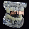 14K Rose Gold Plated Plain Top Teeth Vampire Fangs Grillz