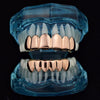 14K Rose Gold Plated Teeth Plain Grillz Set