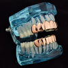 14K Rose Gold Plated Teeth Plain Grillz Set