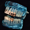 14K Rose Gold Plated Teeth Plain Grillz Set