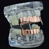 14K Rose Gold Plated Vampire Full Fangs Grillz Set