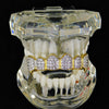 18k Gold Plated 2-Tone CZ Iced Flooded Out Top Fangs Grillz