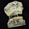 18K Gold Plated CZ Iced Flooded Out Bottom Teeth Grillz