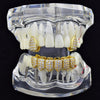 18K Gold Plated Iced CZ 2/6 Teeth Iced Flooded Out Grillz Combo