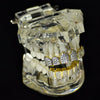 18k Gold Plated Iced CZ 2-Tone Iced Flooded Out Grillz Set