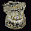 18k Gold Plated Two-Tone Iced CZ Top Teeth Grillz