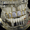 18k Gold Plated Two-Tone Iced CZ Top Teeth Grillz