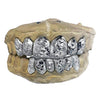 925 Silver Diamond-Cut w/Diamond Dust Single Caps Perm Look Custom Grillz