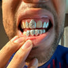 925 Silver Diamond-Cut w/Diamond Dust Single Caps Perm Look Custom Grillz