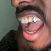 925 Silver Diamond Dust Vampire Fangs Custom Grillz w/Back Bar