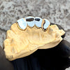 925 Silver Four Teeth Grillz with Open Face & Inlay Side Bar Grills