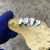 925 Sterling Silver 4 Tooth /1 Open Custom Side Teeth Grillz