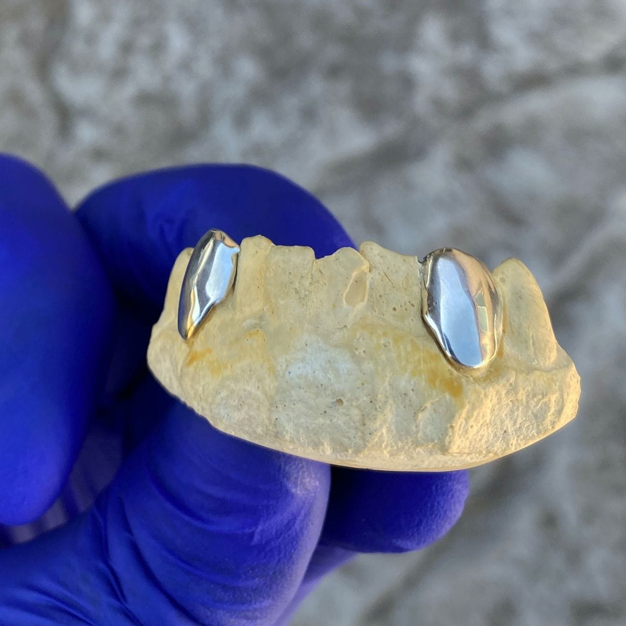 Temporary Silver Rear Tooth Cap 925 Sterling Silver Custom Canine Teeth Caps