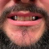 925 Sterling Silver Custom Canine Tooth Caps Teeth Grillz Set