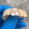925 Sterling Silver Double Cap Heart Cutout & Open Face Tooth Custom Grillz