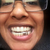 925 Sterling Silver Double Side Canine Teeth Caps Custom Grillz