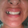 925 Sterling Silver Single Cap Custom Grillz (Choose Any Tooth)