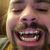 925 Sterling Silver Vampire Canine Fangs Custom Grillz